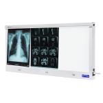 Negatoskopy slim LED NGP